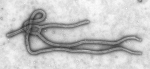 800px-Ebola_Virus_TEM_PHIL_1832_lores